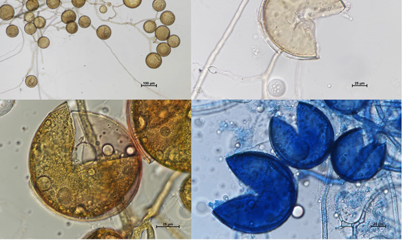 DAOM 212349 Rhizophagus irregularis